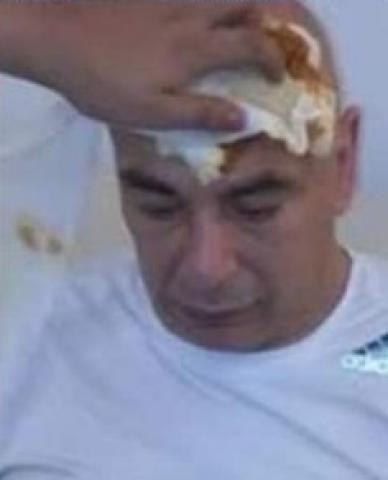 اصابة حسام حسن في الراس اثر تعرضة للأعتداء من جماهير فيتا كلوب